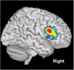 Brain Imaging image